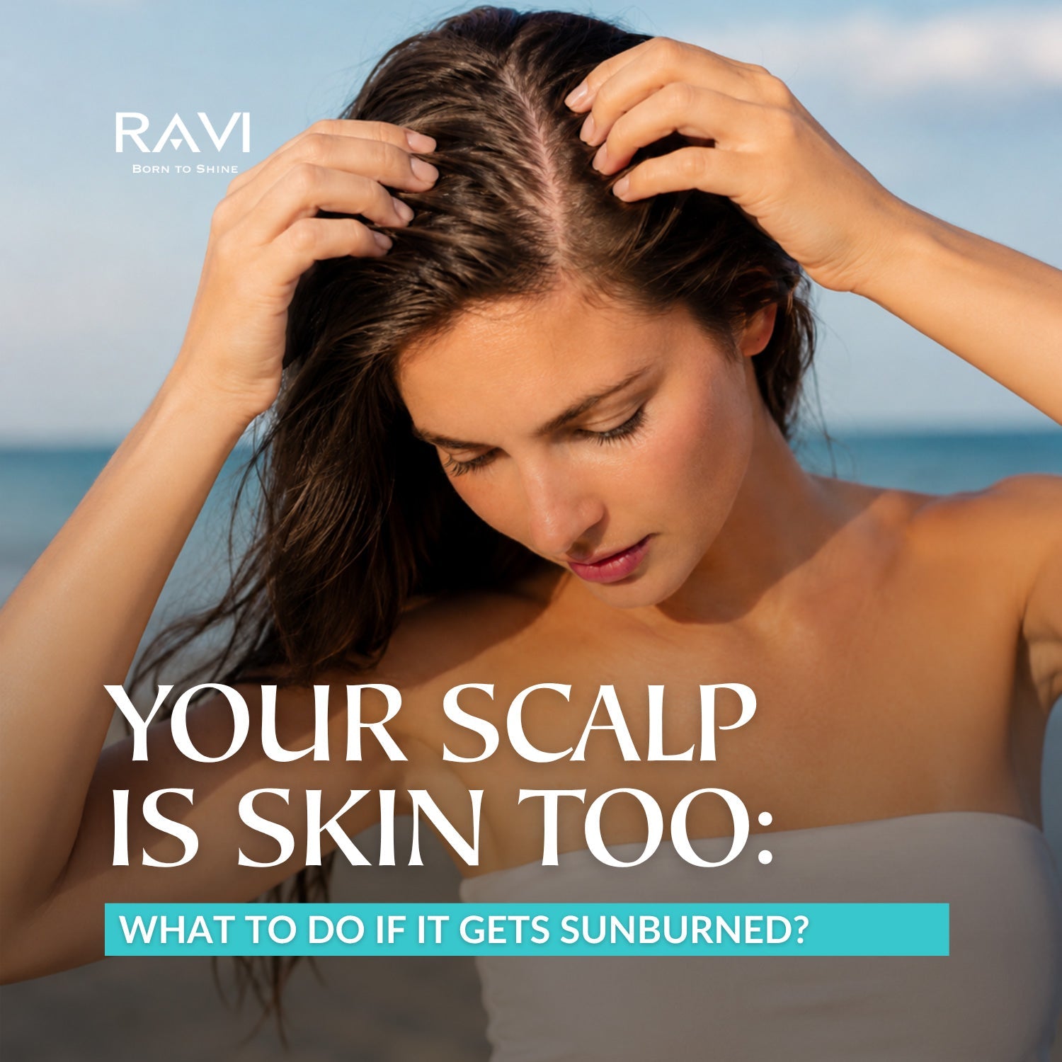 Your Scalp Is Skin Too: What to Do About a Sunburned Scalp
